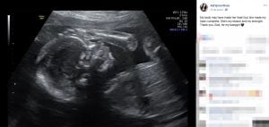 Meet Derrick Henry's Girlfriend Adrianna Rivas (Bio, Wiki)